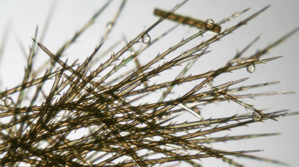 Risques sanitaires et réflexes d'urgence en cas de contact ⚠️